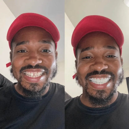 Whitevelle™ Instant Smile Veneers - Pure XO
